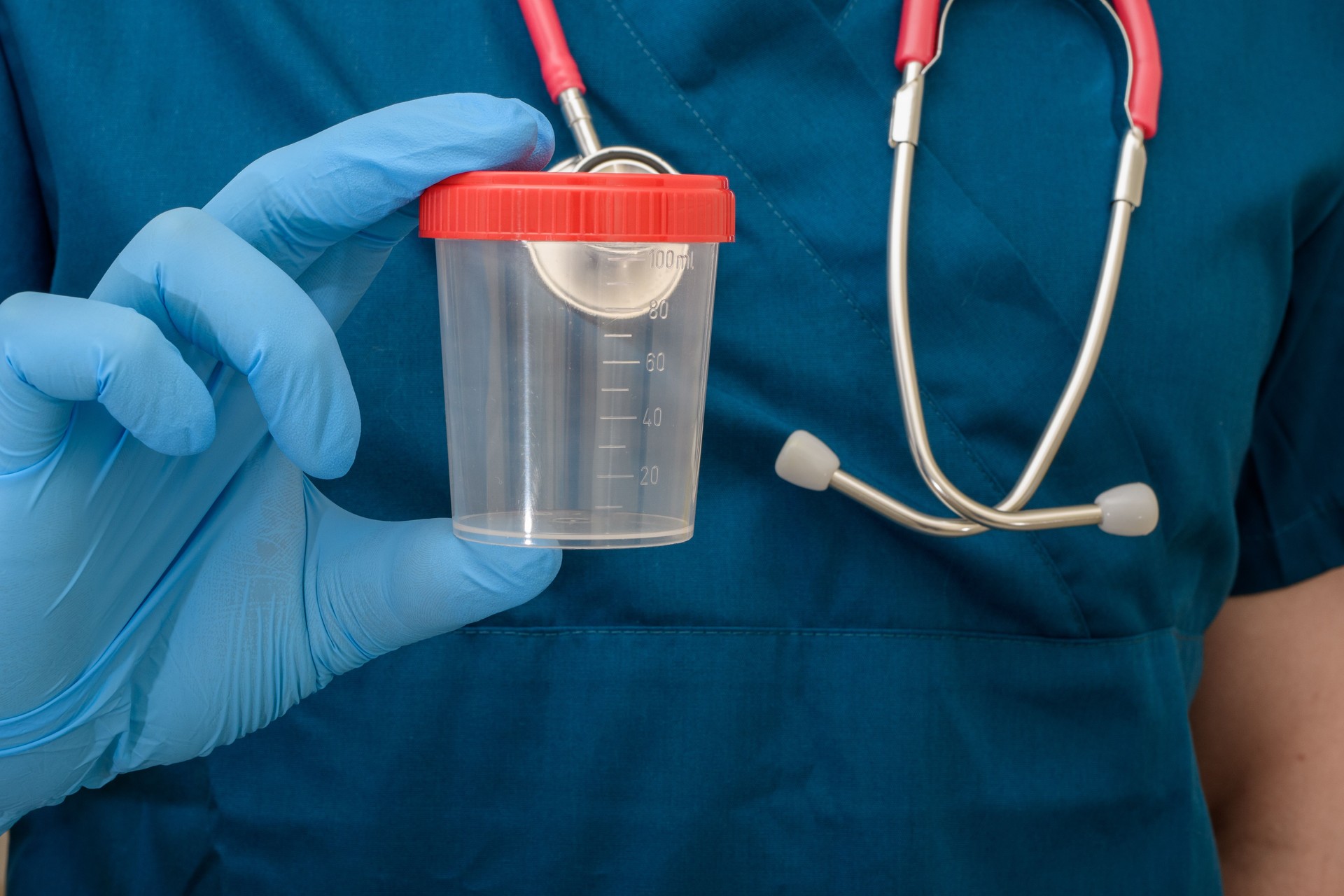 The doctor holds an empty urine container in his hands